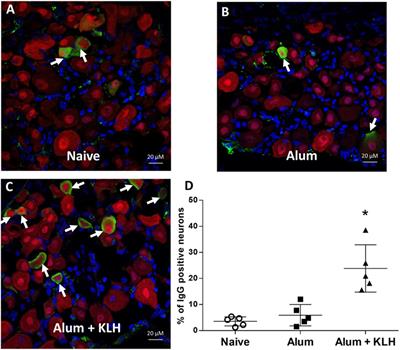 Immunization Elicits Antigen-Specific Antibody Sequestration in Dorsal Root Ganglia Sensory Neurons